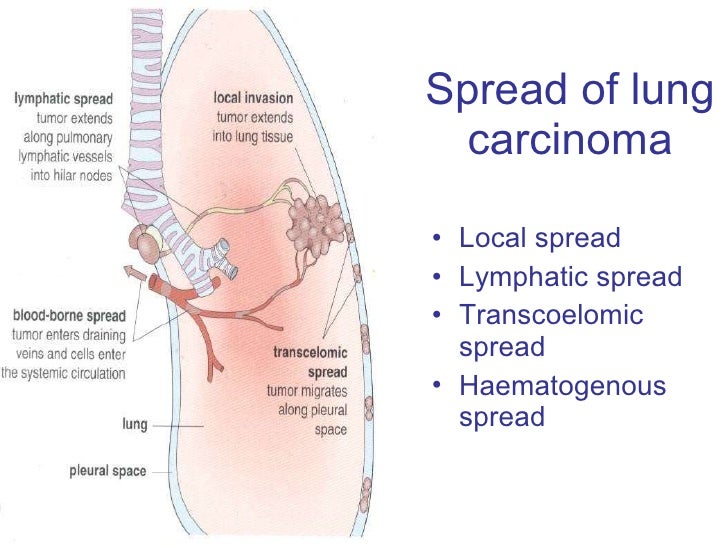 Local Invasion and Spread of Cancer